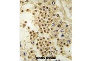 Formalin-fixed and paraffin-embedded human testis tissue reacted with LIN28A antibody (C-term) (ABIN6243718 and ABIN6578921) , which was peroxidase-conjugated to the secondary antibody, followed by DAB staining. (LIN28A antibody  (C-Term))
