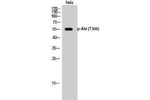 Western Blotting (WB) image for anti-V-Akt Murine Thymoma Viral Oncogene Homolog 1 (AKT1) (pThr308) antibody (ABIN3179385) (AKT1 antibody  (pThr308))