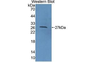 Western blot analysis of the recombinant protein. (CDC42 antibody  (AA 1-188))