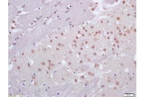 Formalin-fixed and paraffin embedded mouse brain labeled with Anti-CRX1 Polyclonal Antibody, Unconjugated  at 1:200 followed by conjugation to the secondary antibody and DAB staining (CRX antibody  (AA 51-150))