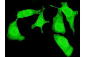 Immunofluorescence of monoclonal antibody to TRIP10 on HeLa cell. (TRIP10 antibody  (AA 231-329))