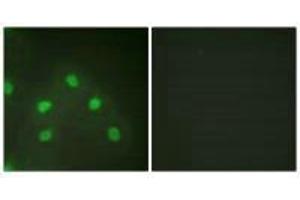 Immunofluorescence analysis of HeLa cells, using hnRNP L antibody. (HNRNPL antibody  (N-Term))