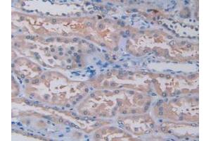 Figure. (TPSAB1 antibody  (AA 161-262))