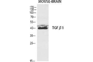 Western Blot analysis of various cells using TGFβ1 Polyclonal Antibody diluted at 1:2000. (TGFB1 antibody  (AA 310-390))