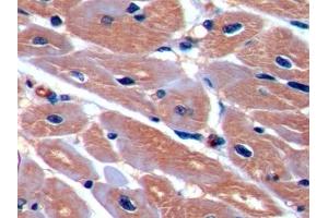 Detection of ICAM1 in Porcine Cardiac Muscle Tissue using Polyclonal Antibody to Intercellular Adhesion Molecule 1 (ICAM1) (ICAM1 antibody  (AA 27-209))