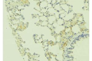 ABIN6269242 at 1/100 staining Human lung tissue by IHC-P. (CASR antibody  (C-Term))