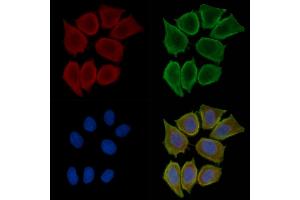 ABIN6260446 and ABIN6276575 staining Hela cells(30 min of UV treatment) by IF/ICC.