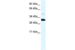 Annexin A3 antibody used at 1. (Annexin A3 antibody  (N-Term))