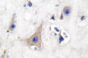 Image no. 2 for anti-Solute Carrier Family 2 (Facilitated Glucose Transporter), Member 3 (SLC2A3) antibody (ABIN265443) (SLC2A3 antibody)