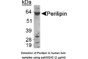 Image no. 1 for anti-Perilipin 1 (PLIN1) (C-Term) antibody (ABIN363551) (PLIN1 antibody  (C-Term))
