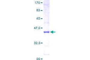ZNF611 Protein (AA 1-151) (GST tag)