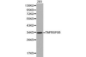 Western blot analysis of 293 cell lysate using TNFRSF6B antibody. (TNFRSF6B antibody  (AA 35-300))