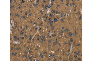 Immunohistochemistry (IHC) image for anti-Hydroxysteroid (17-Beta) Dehydrogenase 2 (HSD17B2) antibody (ABIN2430252) (HSD17B2 antibody)