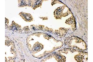 IHC analysis of DBI using anti-DBI antibody . (Diazepam Binding Inhibitor antibody  (AA 2-87))