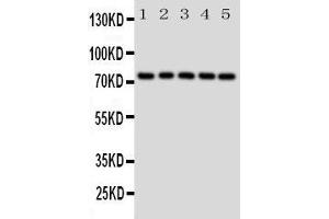 Western Blotting (WB) image for anti-Heat Shock 70kDa Protein 9 (Mortalin) (HSPA9) (AA 591-609), (C-Term) antibody (ABIN3043052) (HSPA9 antibody  (C-Term))