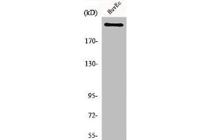 Western Blot analysis of HuvEc cells using Na+ CP-pan Polyclonal Antibody (SCN1A/SCN2A/SCN3A/SCN4A/SCN5A/SCN8A/SCN9A/SCN1A/SCN11A (Internal Region) antibody)