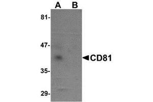 Western blot analysis of CD81 in human lung tissue lysate with AP30217PU-N CD81 antibody at 1 μg/ml in (A) the absence and (B) the presence of blocking petide.