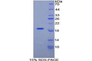 SDS-PAGE analysis of Rat alpha Lactalbumin Protein. (LALBA Protein)