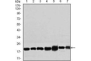 Western blot analysis using RPL18A mouse mAb against NIH3T3 (1), HEK293 (2), HL60 (3), Jurkat (4), Raji (5), MOLT4 (6), and HeLa (7) cell lysate. (RPL18A antibody  (AA 50-176))