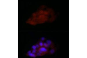 Immunofluorescence analysis of HepG2 cells using TI Rabbit pAb (2523) at dilution of 1:100 (40x lens). (TIA1 antibody  (C-Term))
