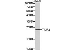 Western blot analysis of extracts of SW480 cell lines, using TIMP2 antibody. (TIMP2 antibody  (AA 100-200))