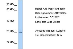 Western Blotting (WB) image for anti-Progestin and AdipoQ Receptor Family Member IV (PAQR4) (C-Term) antibody (ABIN2785146) (PAQR4 antibody  (C-Term))