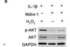 DNM1L deficiency reduces ROS production and autophagy in FLS. (GAPDH antibody)