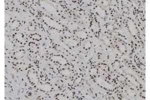 ABIN6262196 and ABIN6278236 at 1/100 staining Human kidney tissue by IHC-P. (HDLBP antibody  (N-Term))