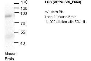 Image no. 1 for anti-Lanosterol Synthase (2,3-Oxidosqualene-Lanosterol Cyclase) (LSS) (N-Term) antibody (ABIN2777020) (LSS antibody  (N-Term))