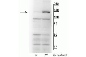 Western blot of HeLa cell lysates that had been treated with UV (~254 nm) for 0’ or 20’ showing specific immunolabeling of the ~150 kDa FANCI protein phosphorylated at Ser559. (FANCI antibody  (pSer556))