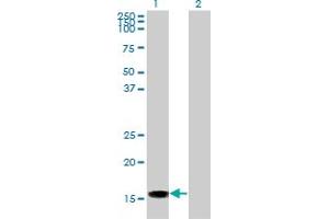 Western Blot analysis of ACP1 expression in transfected 293T cell line by ACP1 monoclonal antibody (M01), clone 4B10.