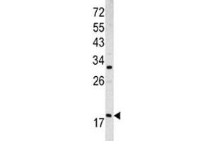 Western blot analysis of ARF3 antibody and MCF-7 lysate (ARF3 antibody  (AA 78-106))