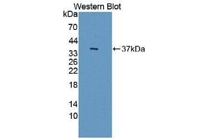Detection of Recombinant AANAT, Rat using Polyclonal Antibody to Arylalkylamine-N-Acetyltransferase (AANAT) (AANAT antibody  (AA 22-235))