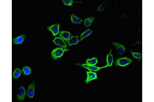 Immunofluorescent analysis of A549 cells using ABIN7170036 at dilution of 1:100 and Alexa Fluor 488-congugated AffiniPure Goat Anti-Rabbit IgG(H+L) (ATP1A1 antibody  (AA 225-407))