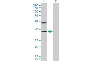 Western Blot analysis of KDELR2 expression in transfected 293T cell line by KDELR2 MaxPab polyclonal antibody. (KDELR2 antibody  (AA 1-212))