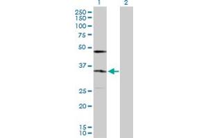 Western Blotting (WB) image for anti-KDEL (Lys-Asp-Glu-Leu) Endoplasmic Reticulum Protein Retention Receptor 2 (KDELR2) (AA 1-212) antibody (ABIN524402)