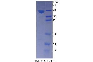 SDS-PAGE analysis of Mouse SNUPN1 Protein.