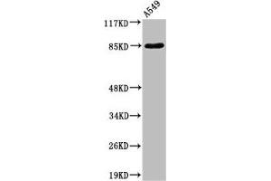Western Blot analysis of A549 cells using ADAM10 Polyclonal Antibody (A Disintegrin and Metallopeptidase Domain 1a (ADAM1A) (Internal Region) antibody)