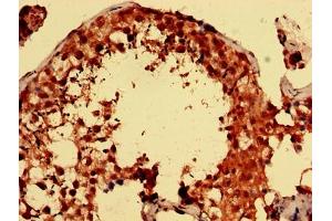 Immunohistochemistry analysis of human testis tissue using ABIN7166460 at dilution of 1:100 (PARK7/DJ1 antibody  (AA 1-188))