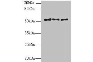 Western blot All lanes: TRIML1 antibody at 3 μg/mL Lane 1: Mouse kidney tissue Lane 2: Human placenta tissue Lane 3: A431 whole cell lysate Secondary Goat polyclonal to rabbit IgG at 1/10000 dilution Predicted band size: 54 kDa Observed band size: 54 kDa (TRIML1 antibody  (AA 277-468))