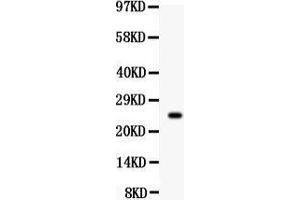 Observed bind size: 25KD (Prolactin antibody  (AA 29-227))
