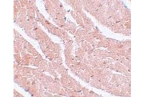 Immunohistochemical staining of mouse heart tissue with MTUS2 polyclonal antibody  at 5 ug/mL dilution. (CAZIP antibody  (C-Term))