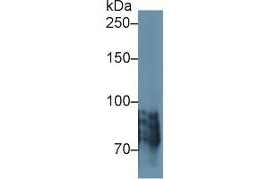 Western blot analysis of Human BXPC3 cell lysate, using Human POSTN Antibody (1 µg/ml) and HRP-conjugated Goat Anti-Rabbit antibody ( (Periostin antibody  (AA 500-630))