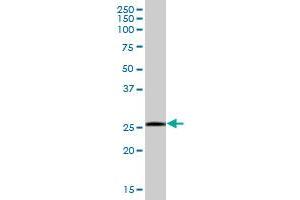SSPN MaxPab polyclonal antibody. (SSPN antibody  (AA 1-243))