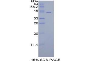 SDS-PAGE analysis of Human HIST1H2AA Protein. (HIST1H2AA Protein)
