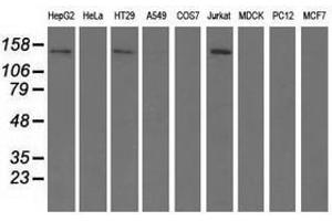 Image no. 2 for anti-Histone Deacetylase 6 (HDAC6) antibody (ABIN1498621)