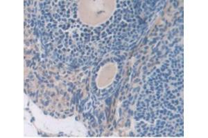 Immunohistochemistry (IHC) image for anti-Serpin Peptidase Inhibitor, Clade G (C1 Inhibitor), Member 1 (SERPING1) (AA 397-495) antibody (ABIN7438463)