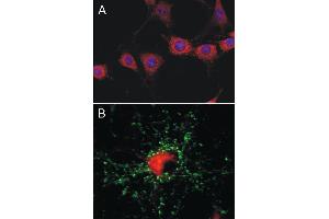A: Indirect immunolabeling of 3T3 cells (dilution 1 : 500). (CHRNB1 antibody)