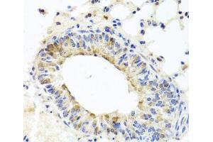Immunohistochemistry of paraffin-embedded Mouse lung using MUC16 Polyclonal Antibody at dilution of 1:100 (40x lens). (MUC16 antibody)
