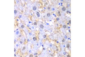 Immunohistochemistry of paraffin-embedded human liver injury using FAH antibody. (FAH antibody)